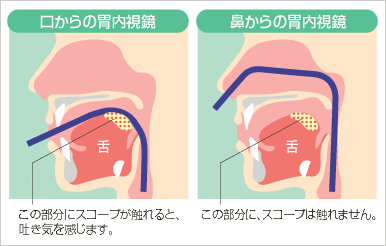 胃カメラ・経鼻内視鏡検査