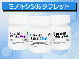 ミノキシジルタブレット